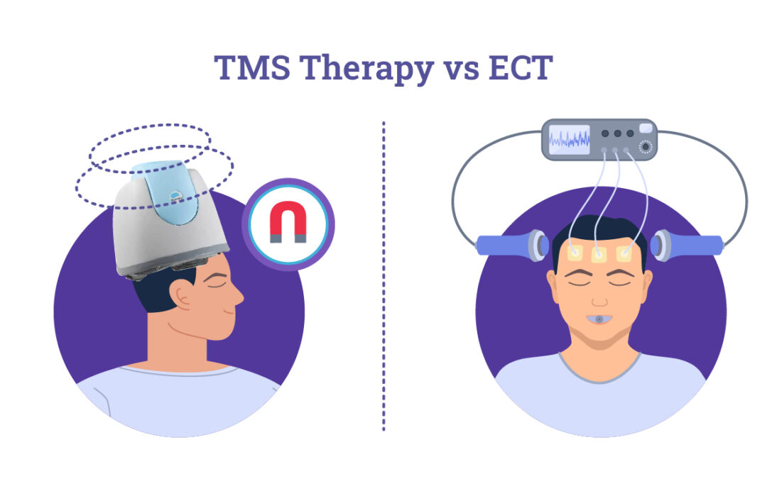 Decoding the Mystery: Study to Uncover Neurobiological Mechanisms of ECT and TMS in Depression Treatment