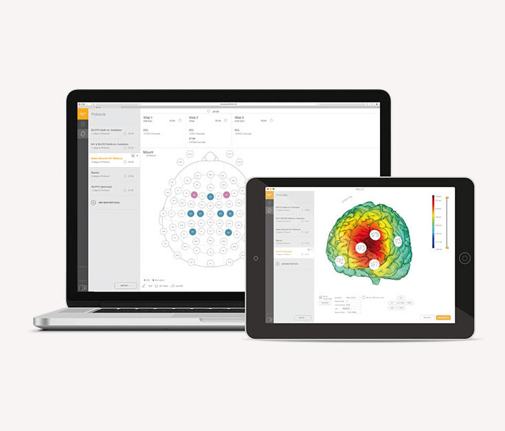 Top 10 EEG Data Analysis Tools for Effective Brain Research